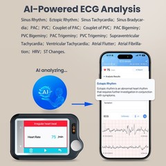 Touch Screen EKG Monitor Heart Monitor with ECG Cable AI-ECG Analysis via App