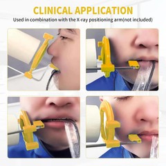 5PCS Dental X-Ray Aiming Ring Kit for Posterior Yellow, Fully Autoclavable
