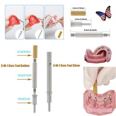 US Locator Tapered Overdenture Abutment Fit Hiossen/NobelActive /Zimmer/Adin/MIS