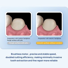 Dental Surgical Brushless LED Electric Micro Motor / LED 1:1/1:5/1:4.2 Handpiece