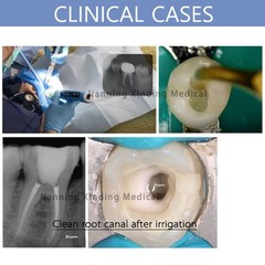 Eighteeth Ultra X Cordless Ultrasonic Endo Activator Root Canal Irrigator