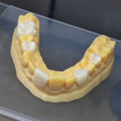 C14 Ceramic Blocks Lithium Disilicate Cerec CAD CAM HT/LT/MT A1 A2 A3 10Pcs/Box