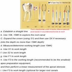 6 Pcs Dental Endodontic NiTi Engine Use Heat Activated Rotary Files 19/21/25mm