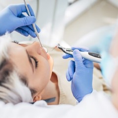 AZDENT Dental Wireless 16:1 LED Endo Motor handpiece Endomotor Machine