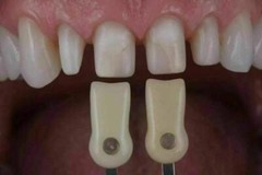 Dental IPS Natural Die Material Shade Guide Ivoclar Vivadent ND1-9 Abutment
