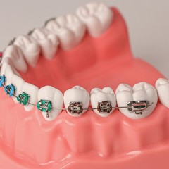 US 1:1 Dental Orthodontic Teeth Model Typodont Demonstration Model with Brackets