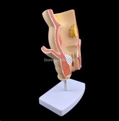 Anatomical Human Rectum Pathology Lesion Model Hemorrhoids Anus Teaching Supply