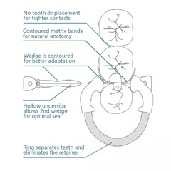 Dental Matrix Bands Ring Sectional Matrice Clamp Fit Garrison Palodent V3 System