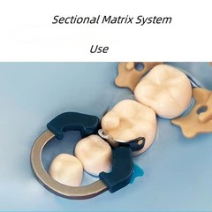 Dental Matrix Bands Ring Sectional Matrice Clamp Fit Garrison Palodent V3 System