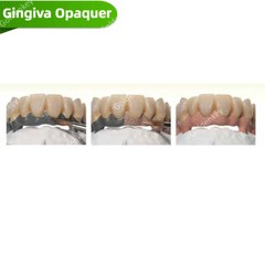 4g Gingiva Opaque Shade Composite Gel Dental Opaquer Pink Gum Mask Denture Layer