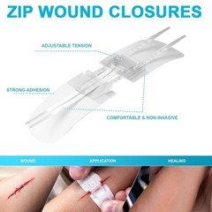 Wound Closure Strips Sterile Skin Suture Strip 5PCS First Aid Adhesive…