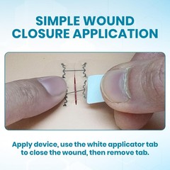 Micromend Emergency Wound Closure Kit Laceration To Butterfly 6 Sterile Wound