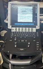 SonoSite M-Turbo Ultrasound System (2014) With 2 Transducer Probe & Rolling Car