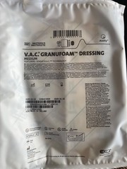 kci wound vac