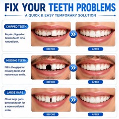 Sukh 10.9oz Moldable False Teeth Beads Thermoplastic Tooth Repair Kit