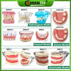 Multiple Types Dental Teeth Model Ortho Implant Practice Teaching Demo Model