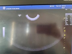 2015 GE IC5-9-D Ultrasound Transducer Probe REF 5492351