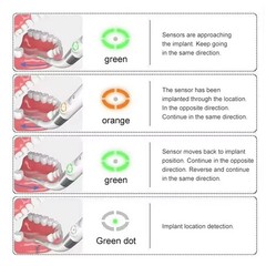 Dental Implant Locator 360° Rotating Minimal Invasive Spotter Detector