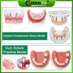 Multiple Types Dental Teeth Model Ortho Implant Practice Teaching Demo Model
