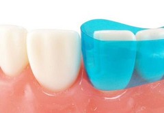 Dental Blue Strip Anterior Matrix Strips IV Composite Matrices Bands