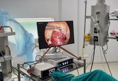 4k Endoscopy Laparoscopic Camera System UHD-LP-6000 Ultra HD Endoscope Camera
