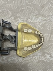 KM-C-210 Articulated Periodontal Soft Clear Gingival Typodont Model