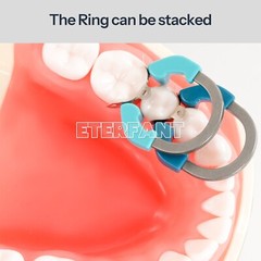 Dental Autoclavable separator rings Bands Matrices Clip Ni-Titanium Fit V3 ring