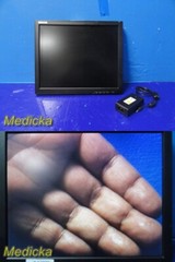 2014 Philips Volcano ESTECOM GEST190LG-PO02 Medical Grade Monitor W/ PSU ~ 32396