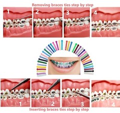 Dental Orthodontic Braces Ligature Ties Elastic Rubber Bands Mixed Color ARTMAN
