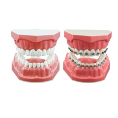 US Dental Typodont Teeth Model with Orthodontic Brackets Brushing