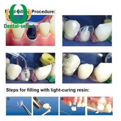 Dental Clear Preformed Crowns Adult Kid Temporary Anterior Posterior Molar Crown