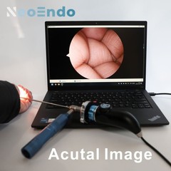 Portable Medical USB Endoscope Camera 1080P Full HD For ENT Inspection