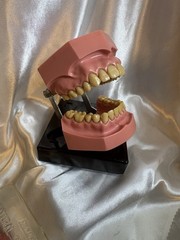 Nissin G.O.F.A. Typodont Natural Study Model D-2501 for Dentistry Lab