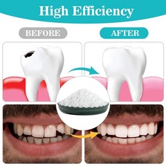 Sukh 10.9oz Moldable False Teeth Beads Thermoplastic Tooth Repair Kit