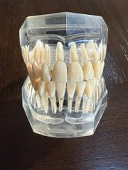 Dental Typodont Model
