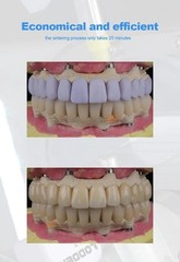 Dental Lithium Disilicate Blocks C14/B40/A16 Glass Ceramic Sirona Cerec LT/MT/HT