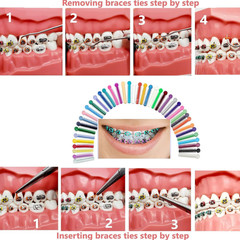 Dental Orthodontic Ligature Ties Elastic Rubber Bands Single/Double Colors USA