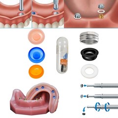 Dental Locator Overdenture Abutment Retention Caps PEEK Implant Inserts 8Pcs/Set