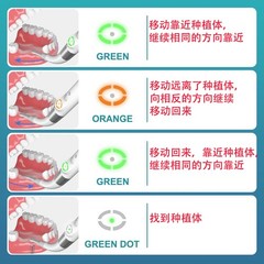 Dental Surgical 360° Rotating Implant Locator 3D Smart Spotting Implant Detector
