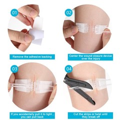 Wound Closure Strips Sterile Skin Suture Strip 5PCS First Aid Adhesive…