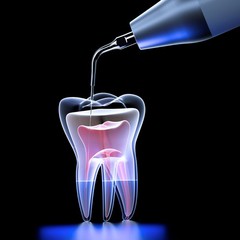 Woodpecker Dental U600 LED Ultrasonic Piezo Scaler 7 Tips Auto Water Supply