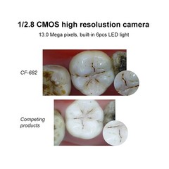 Dental Wireless Oral Viewer Intraoral Camera 1080p HD Intra Oral Camera