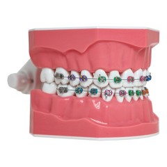 US Dental Typodont Teeth Model with Orthodontic Brackets Brushing