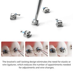 Dental Orthodontic Brackets Brces 1st buccal tube Self Ligating ROTH/MBT 0.022