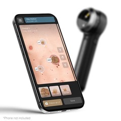 NEW DermLite® DL5+ PLUS Hybrid Polarized/Non-Polarized Pocket Dermatoscope