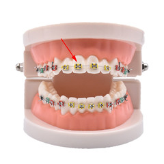 1040Pcs Dental Orthodontic Elastic Ligature Ties Rubber Bands for Brackets Brace