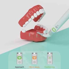 Dental Medical Implant Surgery Wireless Implant Locator Detector 360° Spotting