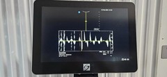 SonoSite X-Porte Ultrasound