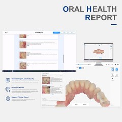 Dental Scanner 3D Real-time Display w/ AI Scanning Software + 4 Tips