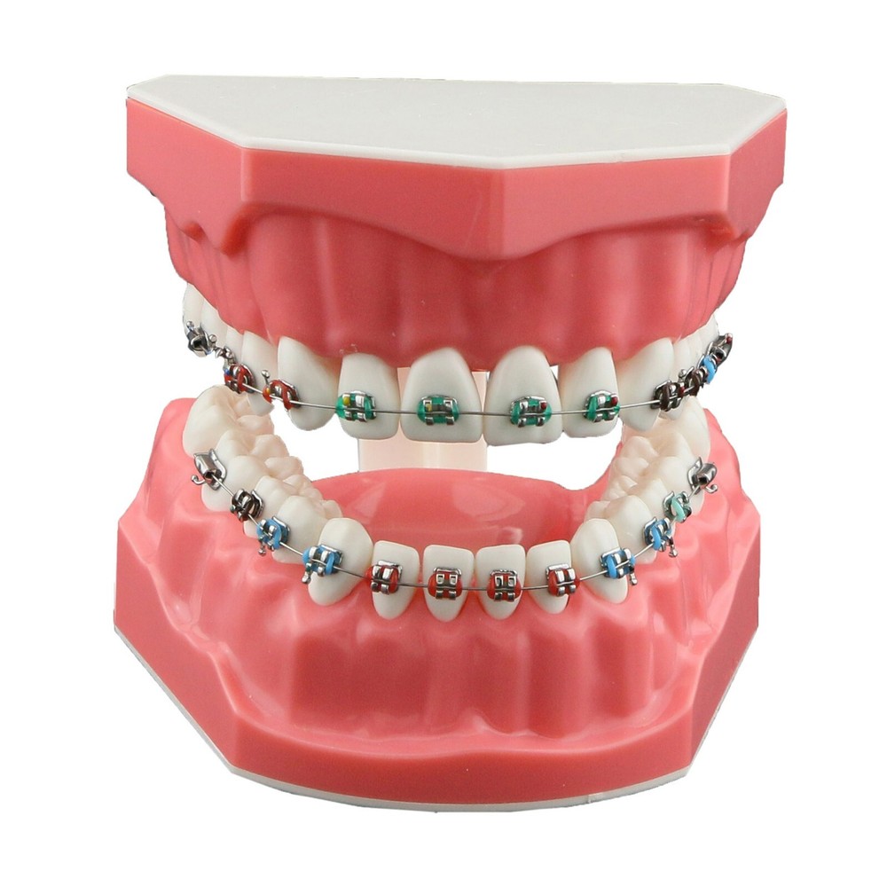 US Dental 1:1 TypodontTeeth Model Orthodontic with Metal Brackets Brace M7010-2